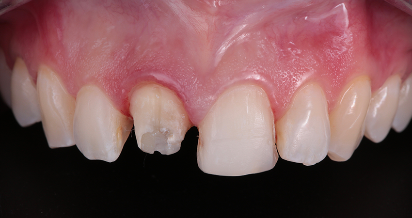 1. Vorbereitung & Reinigung