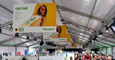 Plandent Summer Sale 2025